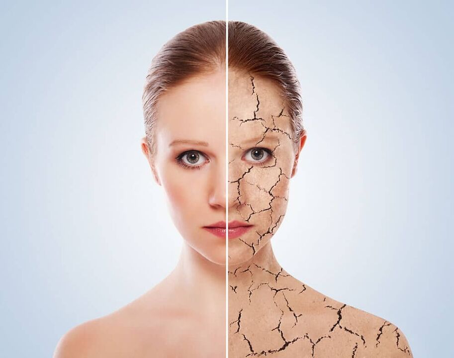 Veselīga āda un psoriāzes skarta āda